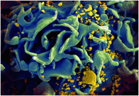 小骚货用大鸡吧操死你在线看开发出靶向HIV病毒库的Dual-CAR-T细胞,为治愈HIV感染奠定基础